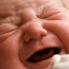 Причины патологической желтухи новорожденных