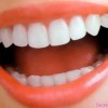 Актуальность имплантации зубов для сохранности здоровья
