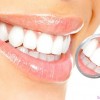 Функция корня зуба, его здоровье и уход за ротовой полостью