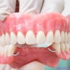 Протезирование зубов на высоком уровне